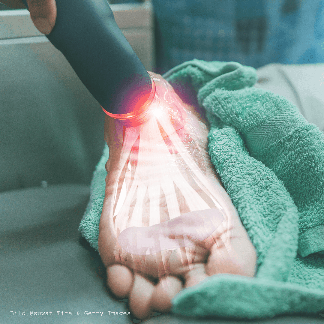 Plantarfaszie fotografisch dargestellt